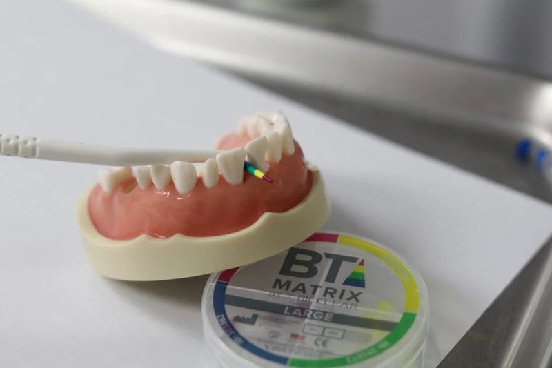 Juodieji trikampiai ir diastemos: kaip juos uždaryti Bioclear metodu