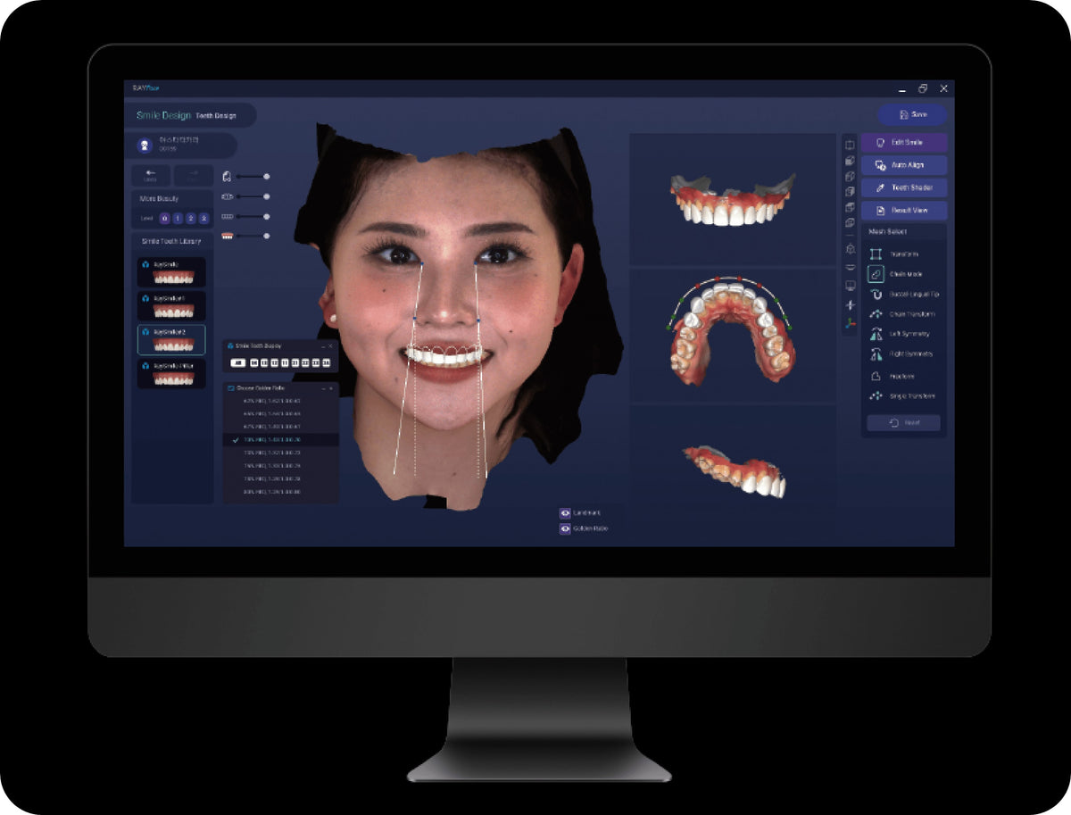 RAYFace programinė įranga – 3D veido modelis su dantų skenavimo duomenimis