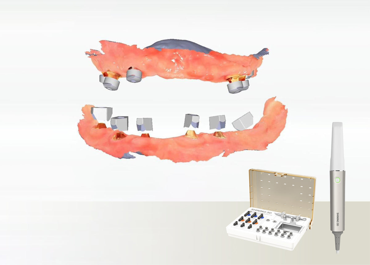 Aoralscan Elite su IPG rinkiniu ir implantų skenavimo duomenimis